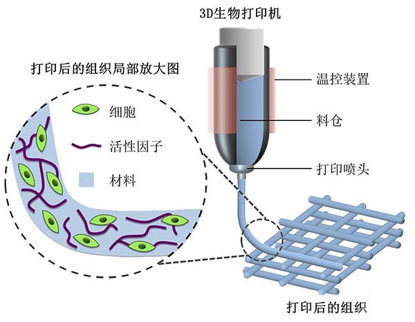 解析基于生物相容性材料的3D打印骨骼修复技